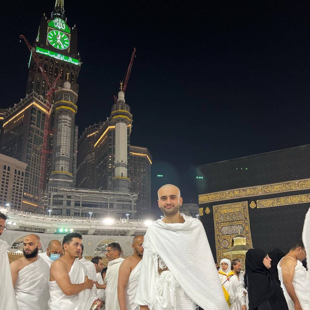 CZN Burak kanser mi? Aşırı zayıflaması korkutmuştu, şimdi de saçlarını kazıttı! 8